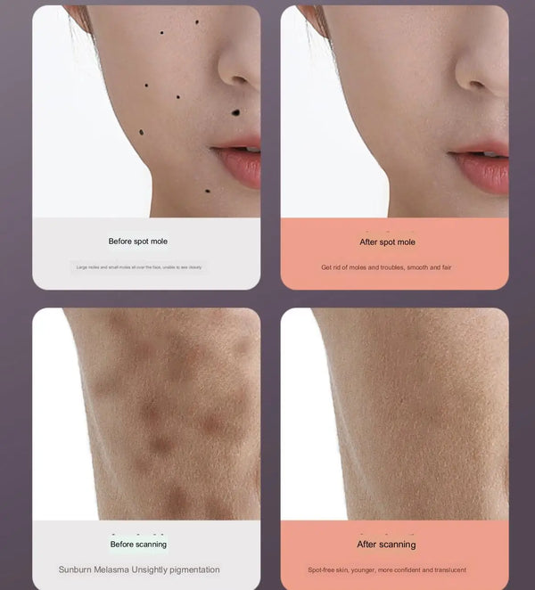 Veiligheidshuidverzorgingspen