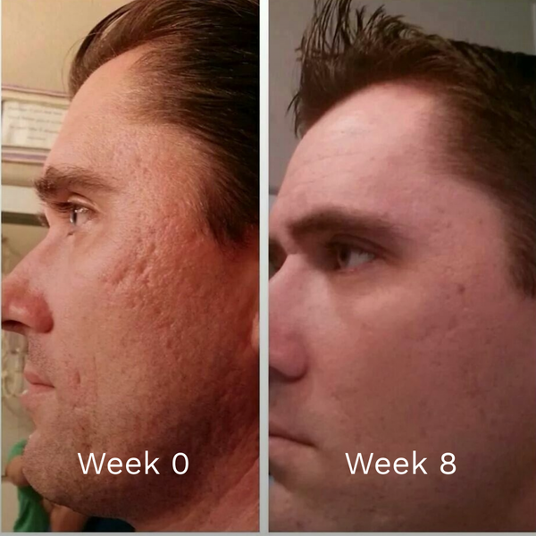 GHKCu Copper Peptide Repair Serum