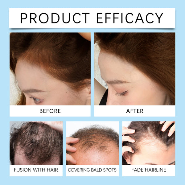 IGK Nooit Meer Uitgroei Spray