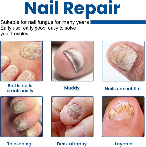 Prachtige Nagelpleisters