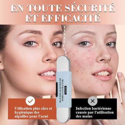 DermaPinch – Krachtig tegen onzuiverheden